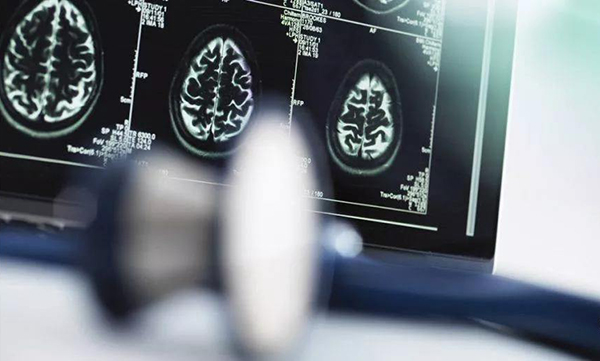 AI醫療目前首要任務是解決醫療難題，而不是鼓吹噱頭-鋒巢網